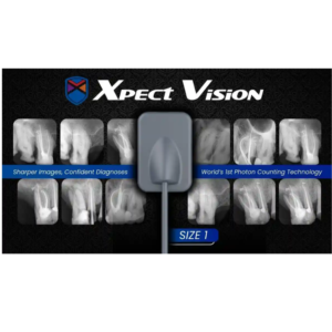 Xpect Vision RVG Sensor for Digital Dental X-Ray Imaging Size 1