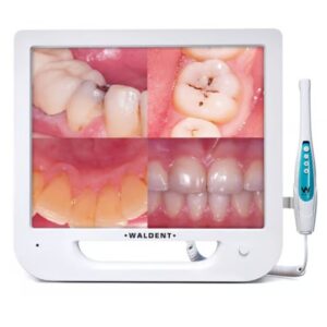 Waldent Intra Oral Camera with Screen Ergo 10 MP and 17-Inch Monitor