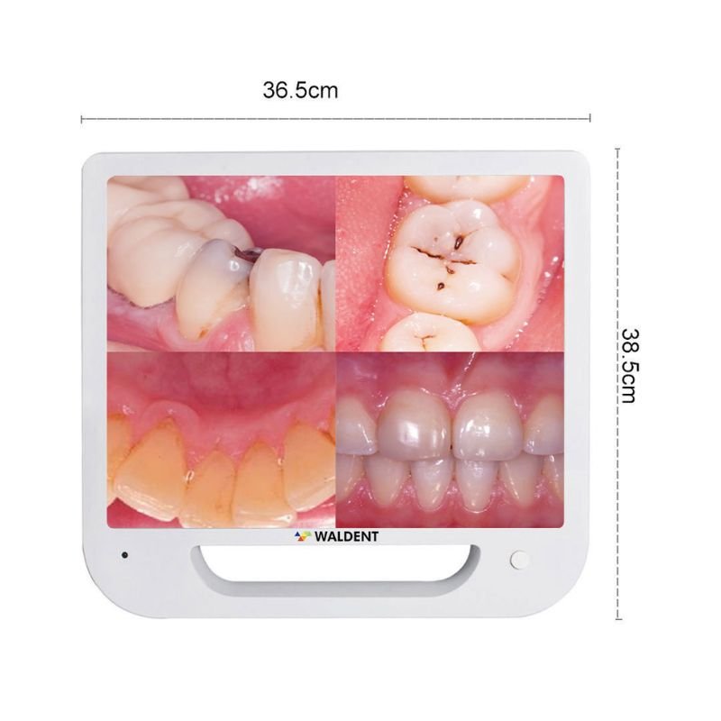 Waldent Intra Oral Camera with Screen – Ergo (10 MP) - Image 2