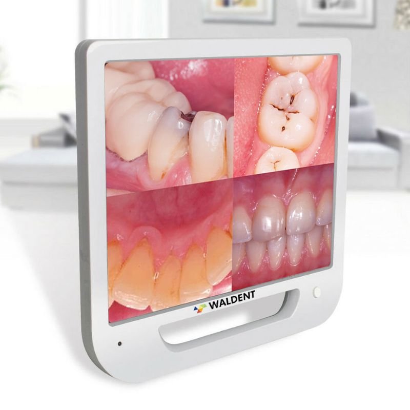 Waldent Intra Oral Camera with Screen – Ergo (10 MP) - Image 3